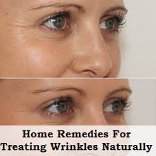 20 Home Remedies For Treating Wrinkles Naturally At Home Health Clue Facial Care Beauty Care Beauty Remedies