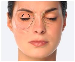 Use of Botulinum Neurotoxin in Parkinson's Disease: A Critical Appraisal