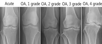 Contoh soal radiologi dan jawabannya. Kumpulan Soal Radiologi Kedokteran Beserta Jawaban Edisi 41 Contoh Uji Kompetensi Radiografer