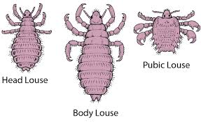 How do you know if you have body lice. Lice Infestation Skin Disorders Merck Manuals Consumer Version