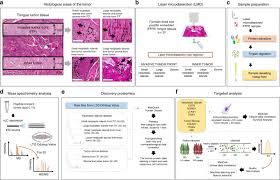 Carolina santana lopes is on facebook. Combining Discovery And Targeted Proteomics Reveals A Prognostic Signature In Oral Cancer Nature Communications