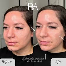 𝐁𝐚𝐫𝐞 𝐀𝐞𝐬𝐭𝐡𝐞𝐭𝐢𝐜𝐬 𝐃𝐚𝐥𝐥𝐚𝐬