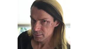 Mishandelde zanger Robby Valentine: 'Ik heb eigenlijk nog geluk gehad'