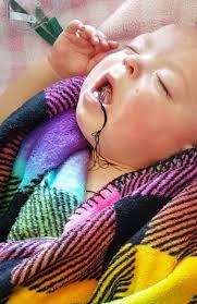 من جهة أخرى، قالت الجمعية الفلكية السورية على لسان رئيسها، محمد العصيري، إن جسم الصاروخ الصيني الذي حمل مركبة الفضاء الصينية سيعبر فوق سوريا عند الساعة 02. Ù…Ø§Ø°Ø§ Ø­Ø¯Ø« Ù„Ù„Ø·ÙÙ„Ø© Ø°Ø§Øª Ø§Ù„Ù„Ø³Ø§Ù† Ø§Ù„Ø¶Ø®Ù…