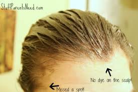 Free shipping on orders over $25 shipped by amazon. Beauty Tip How To Keep Hair Dye Off Your Scalp