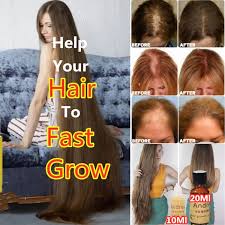 Similarly to growing thicker hair, it all comes down to how you treat your hair and. 10 20ml Hair Growth Essence Long Hair Fast Growth Shampoo Helps Your Hair To Lengthen Grow Longer Wish