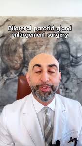 Should both parotid glands be operated