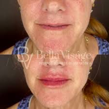 Bella Viságe Medical & Aesthetic Rejuvenation