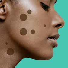 After my toothpaste chemical burn experience, i have decided to strictly use only natural ingredients. 9 Dark Spot Treatments That Really Work According To Dermatologists Self