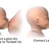 When this happens, you are at greater risk for excessive bleeding and bruising. 1