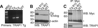 If prostate cancer is suspected based on results of screening tests or symptoms, tests will be needed to be sure. Transgenic Expression Of The Mitochondrial Chaperone Tnfr Associated Protein 1 Trap1 Accelerates Prostate Cancer Development Journal Of Biological Chemistry