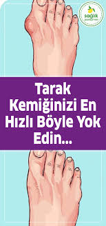 Bas Parmaginin Yaninda Olusan Kemi K Cikintisi Bunyon Nasil Gecer Faydalibilgiler Sifalibitkiler Kalicizayifla Health Detox Health Natural Health Remedies