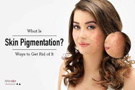 The skin produces excess melanin when it senses. What Is Skin Pigmentation Ways To Get Rid Of It By Dr Nimesh D Mehta Lybrate