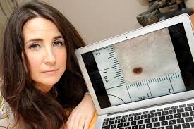 Former sun bed addict SCARED of the sun after skin cancer