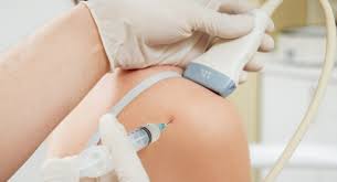 One of the most commonly used medical treatments for arthritis joint pain is the cort. Steroid Injections In Shoulder What Are The Options
