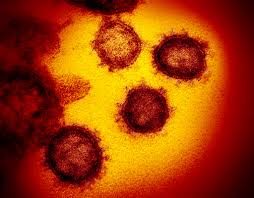 Infectious on plastic or steel after 72 hours. Study Suggests New Coronavirus May Remain On Surfaces For Days National Institutes Of Health Nih