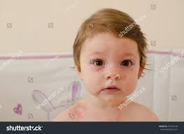 Roseola is a mild viral infection that affects babies and young children. Baby Girl Body Covered With Roseola Skin Rash Royalty Free Stock Photo 477510106 Avopix Com