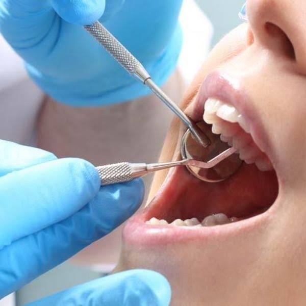 Need a Safe & Gentle Tooth Extraction in Pashan? product image