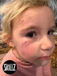 Rooster attacks baby child in the backyard