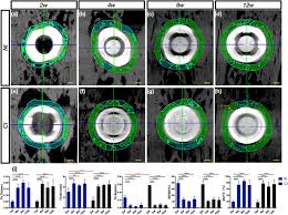 Welcome to the dental grants program the dental grants program provides you with the opportunity to pay less for implants and cosmetic dentistry services. Osseointegration Of A Novel Dental Implant In Canine Scientific Reports