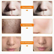 Ilift Professional Led Light Therapy Mask V2 0 Pf Beauty Led Light Therapy Mask Led Light Therapy Light Therapy Mask