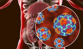 Many cases have few or no symptoms, especially in the young. Hepatitis A Serious Reportable But Preventable
