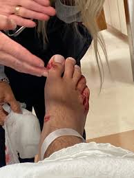 I did it live for the first time at sheffield arena. Wkrg Photos Dad Describes Son S Encounter With Shark Off Coast Of Orange Beach