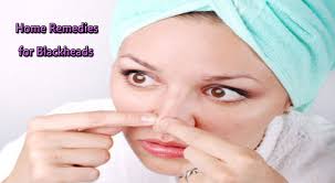 home remes for blackheads indiamarks