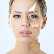 Laser Melasma Treatment in Butte, MT