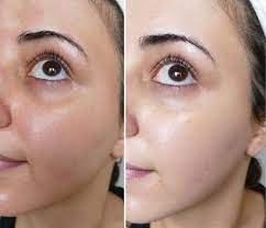 cilt renginizi bir gecede bu yontemle acin saglik paylasimlari cilt rengi cilt urunleri dogal cilt bakimi