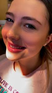 The two newest members of the no braces club! Congratulations Ryan and  Maddie! 🕺🥳🦷