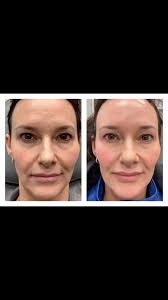 Skin care, injectables and monthly facials/laser will do it. It is a  commitment, just know we can get you there. We LOVE our patients “glow up”.  You can be next., 𝚆𝚒𝚜𝚎 𝙰𝚎𝚜𝚝𝚑𝚎𝚝𝚒𝚌𝚜, 🏠2325 Pointe Parkway ...