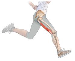 Cruel masters of the middle ages severed the hamstrings of domestic slaves or prisoners in order to curtail escape. Hamstring Injuries Biceps Femoris Semitendinosus Semimembranosus