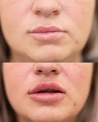 𝐓𝐡𝐞 𝐒𝐤𝐢𝐧 𝐑𝐨𝐨𝐦 (@theskinroomllc) · Instagram 照片和视频