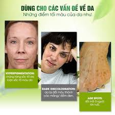 Kem dưỡng làm mờ vết thâm Madeleine Ritchie Dark Spot Remover 20ml