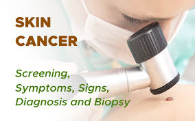 More than 60,000 people are diagnosed with melanoma every year, with nearly 9,000 deaths, according to skin cancer foundation data. Non Melanoma Skin Cancer Screening Symptoms Signs Diagnosis And Biopsy Surgmedia