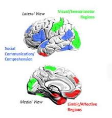 A study published earlier in 2018 should have made headlines everywhere, as it discovered historically high amounts of aluminum in autistic brains. Brain Imaging Shows That Social Brain Circuits Are Disrupted In Autism Bmed Report