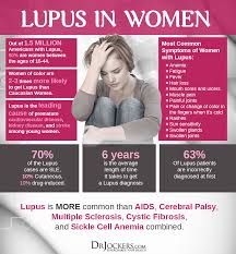 19 Ways To Heal Systemic Lupus Naturally Drjockers Com