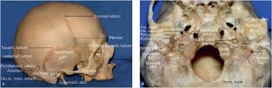 Image result for Temporal Bone