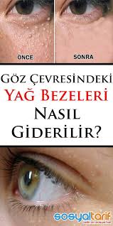 Yag Bezeleri Nasil Gecer Bezeleri Gecer Nasil Yag Healthy Skin Care Dermalogica Skin Care Health