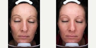 Rejuv Medical Aesthetic Clinic