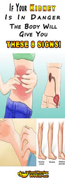 If Your Kidney Is In Danger The Body Will Give You These 8 Signs Body Health Bone Health Kidney Cleanse