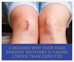 6 Reasons Why Your Knee Surgery Recovery Time Is Taking Longer Knee Replacement Recovery Knee Surgery Recovery Knee Replacement Surgery Recovery