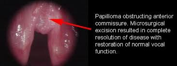 Normal Findings In Vulvar Examination And Vulvoscopy