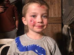 Glynn County boy survives after being hit by car at bus stop