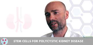New Stem Cell Therapy for Polycystic Kidney Disease