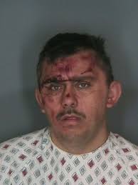 Doctor says driver faked paralyzed legs