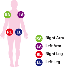 12 Lead Ecg Placement Aed Superstore Resource Center