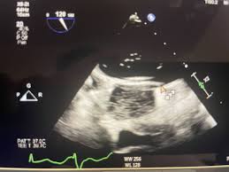 Bildergebnis für Morris Zerner