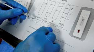 Your sample is returned to labcorp to determine the result. Uk Government Admits Covid 19 Antibody Tests Don T Work Financial Times
